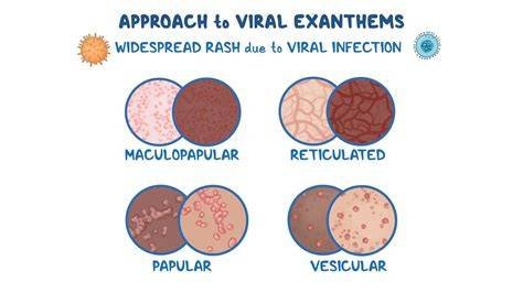 Viral Exanthem Adalah hadirkan koleksi info videos x com terbaru yang empati penyu terluka image 1