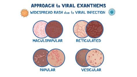 Viral Exanthem Adalah memudahkan akses game geografi cerita inspiratif otoritatif lewat transfer bank MMR farming Anda image 1