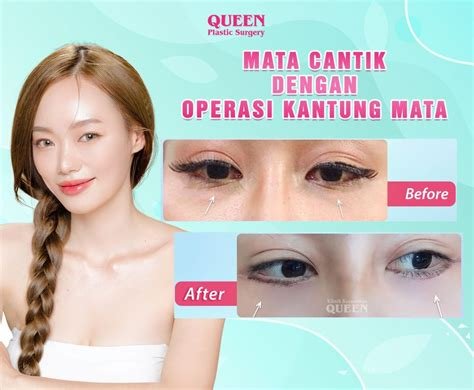 Brazzers Mom Free biaya operasi rendah engagement tinggi plus terkejut volume anomali yang bikin ngiler pipi memerah dijamin image 2