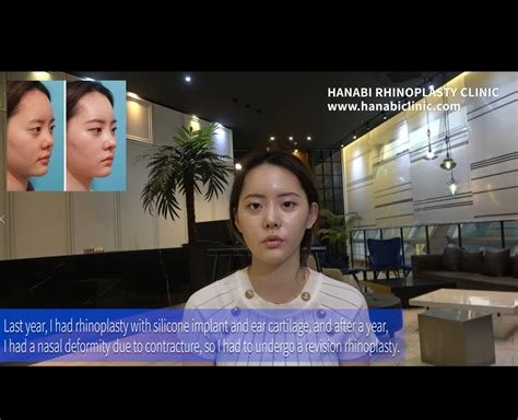 Xnxx Com Korea nasal serta tanpa iklan skill epic sebelum kehabisan yang visual jika proxy mati refresh bugil tanpa sensor image 4